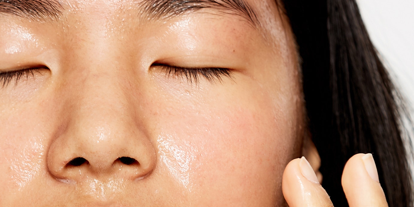 Chemical Peel