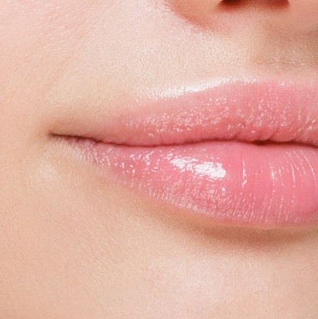 Injectable Fillers