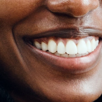 Professional Teeth Whitening