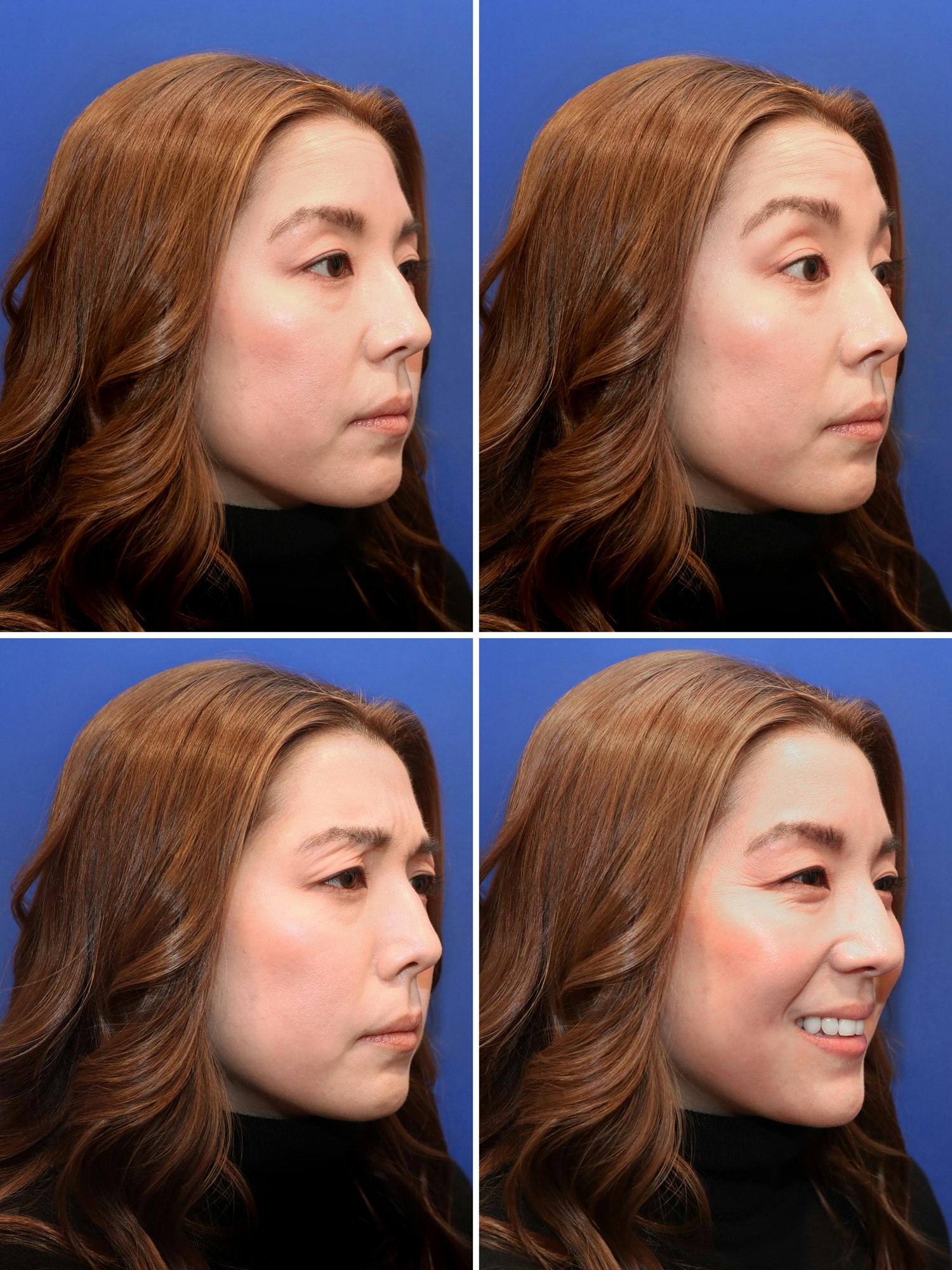 Before treatment