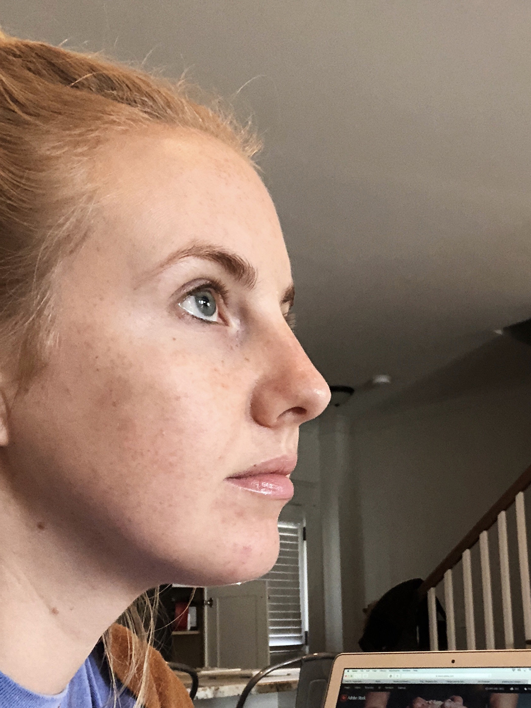 How 1 Bride Planned Her Pre-Wedding Skin and Medical ...