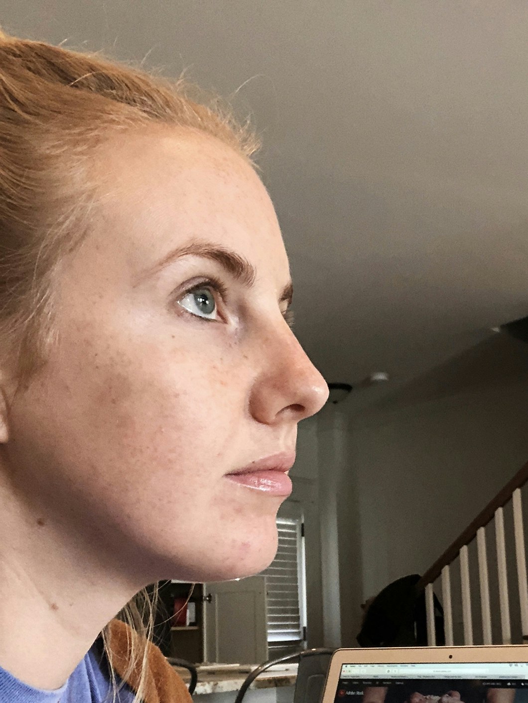 How 1 Bride Planned Her Pre-Wedding Skin and Medical ...