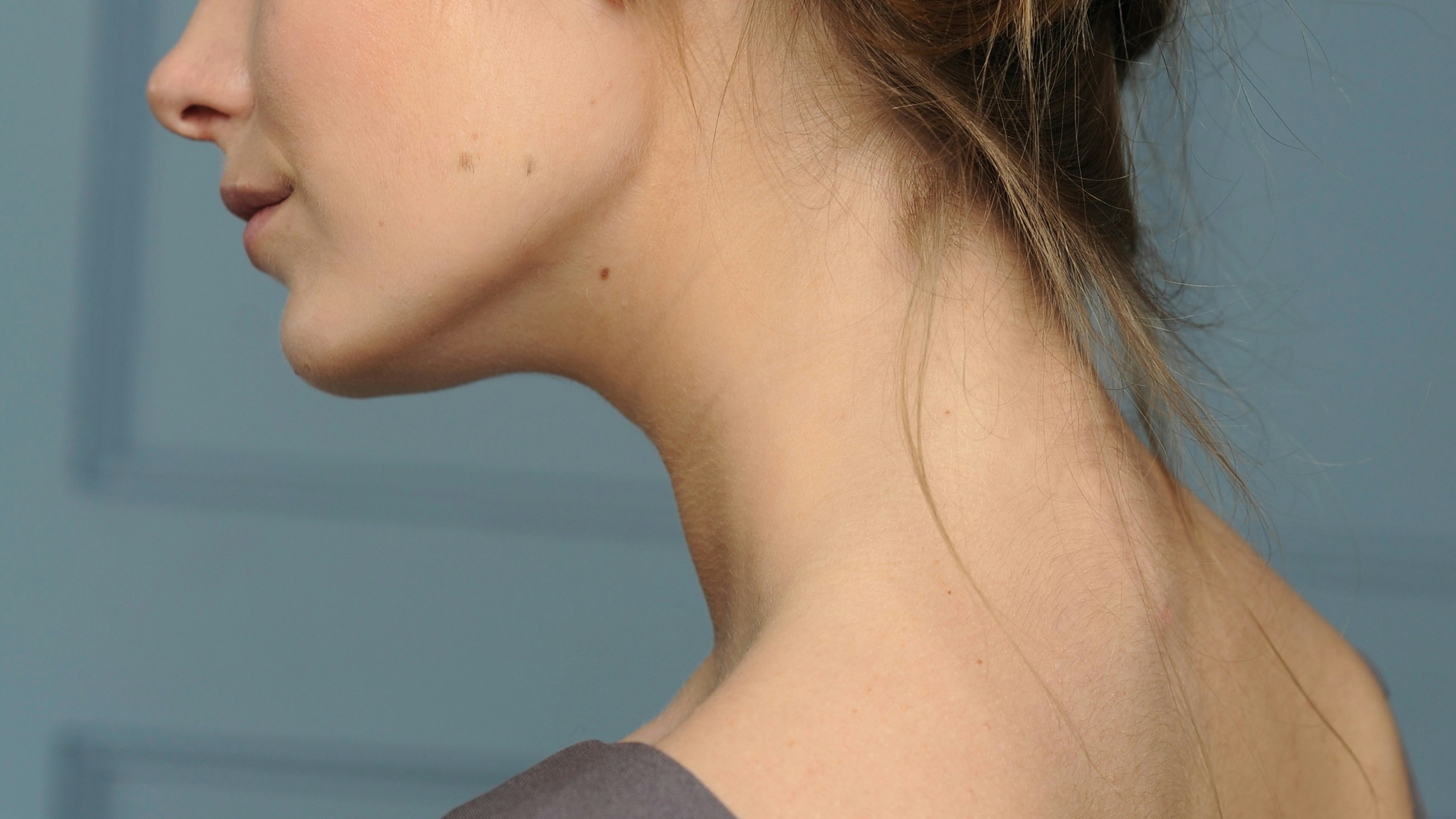 I Had A Double Chin My Whole Life Until I Tried This Treatment