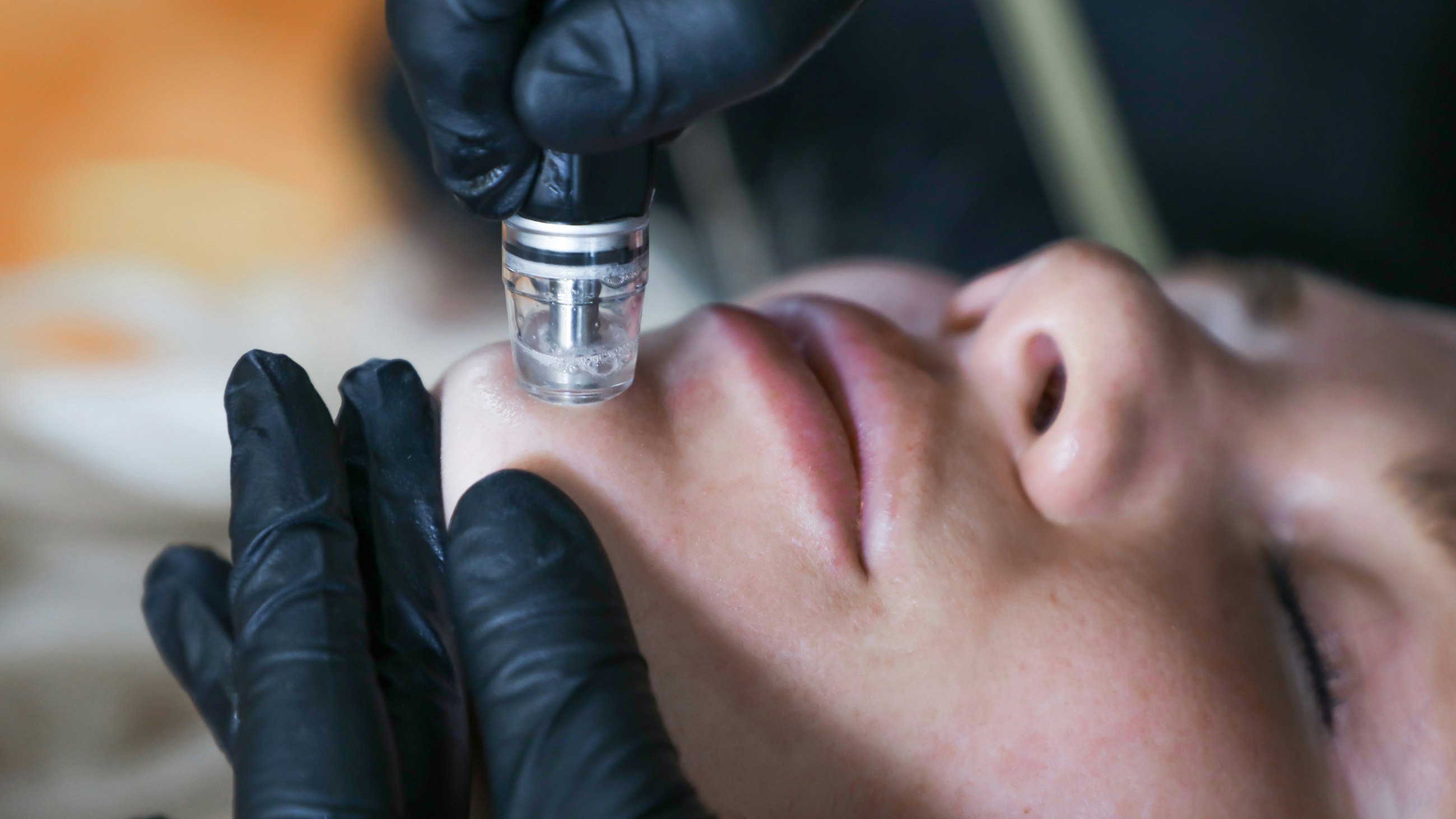 woman receiving diamondglow facial treatment