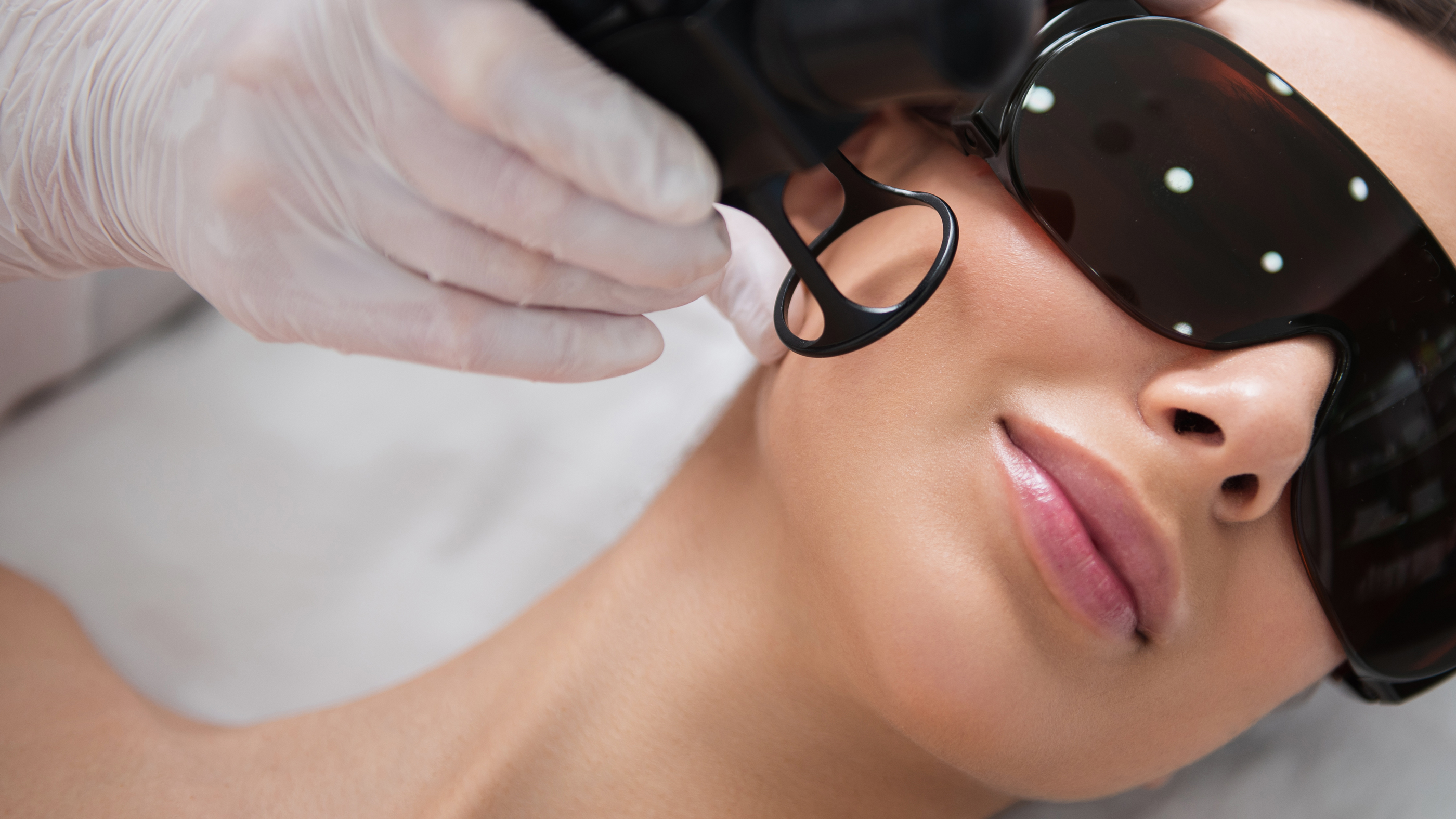 laser treatment