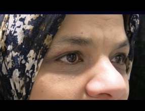 Blepharoplasty Before & After Gallery - Patient 58232293 - Image 2