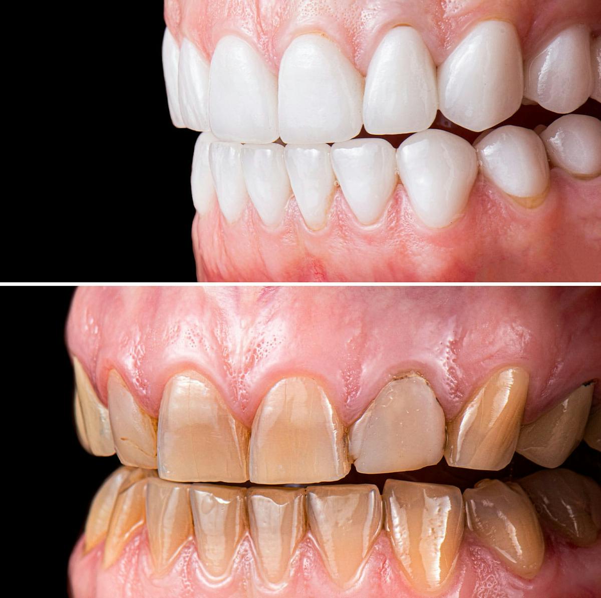 Smile Makeover  Before & After Gallery - Patient 307286 - Image 1