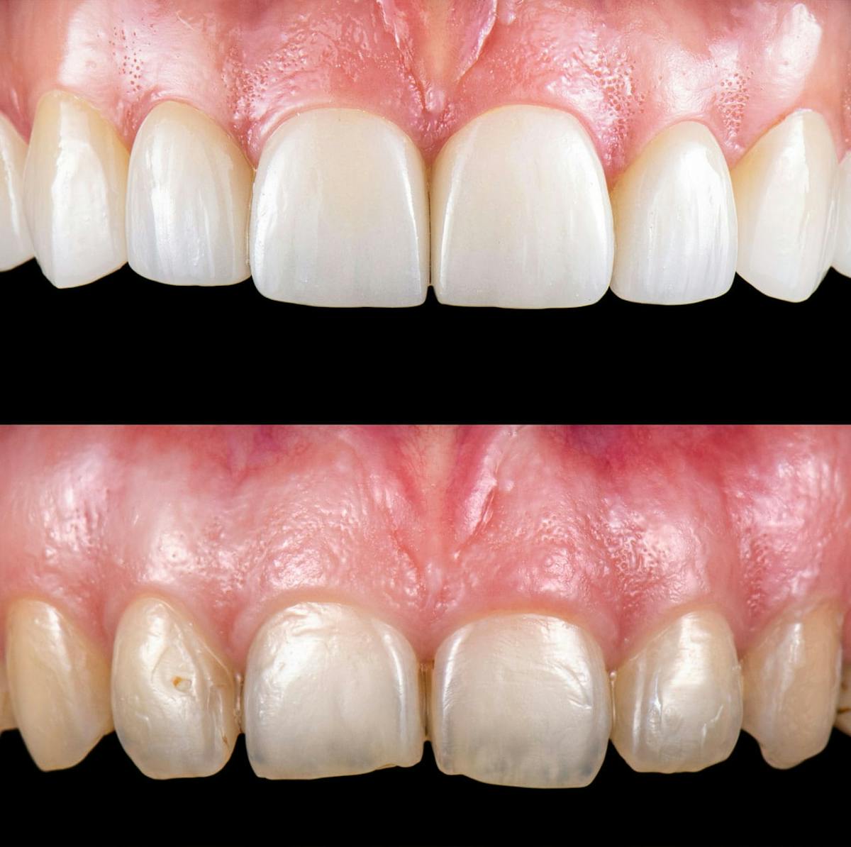 Smile Makeover  Before & After Gallery - Patient 161669 - Image 1