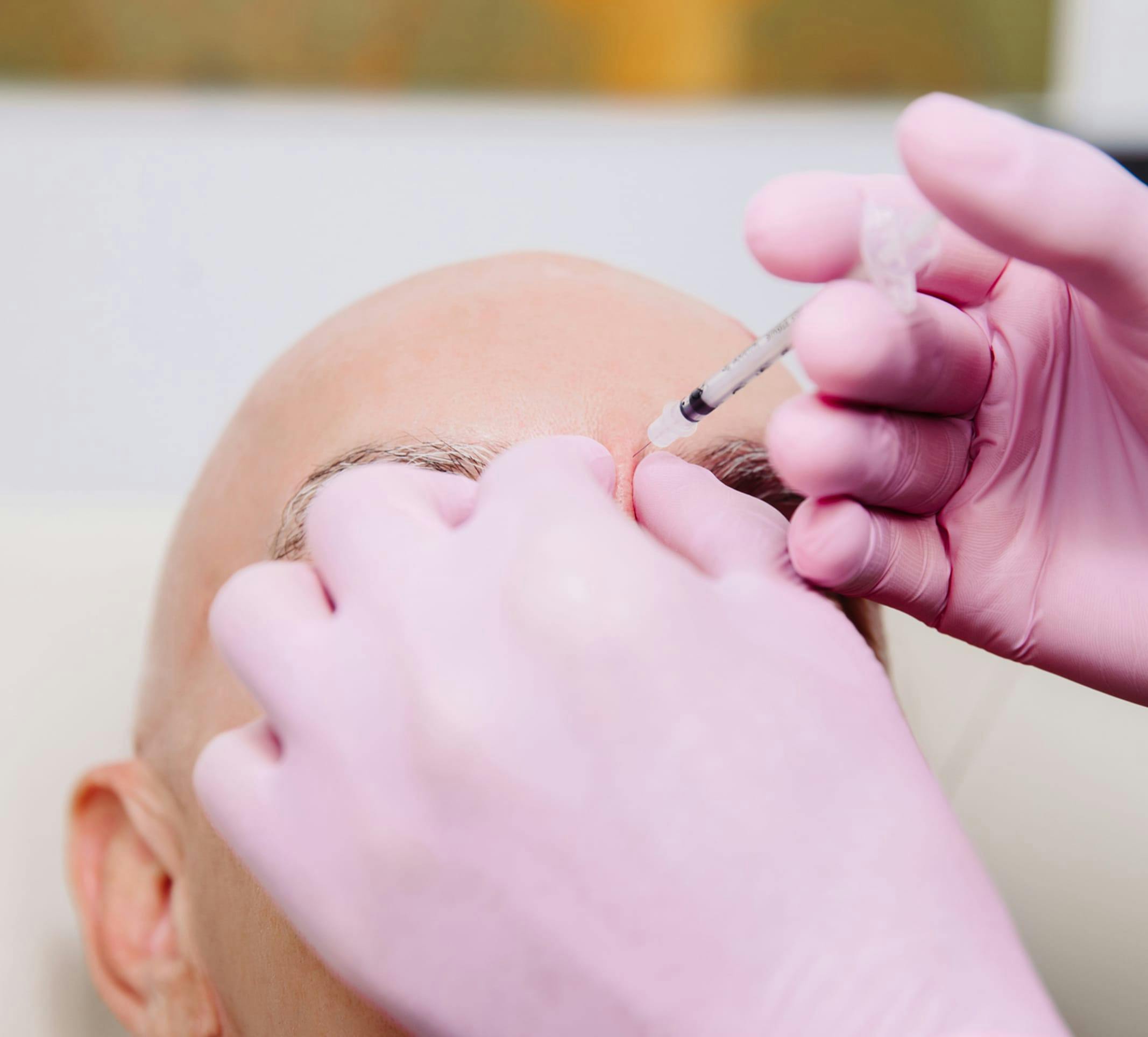 man getting injections in the eyebrow area