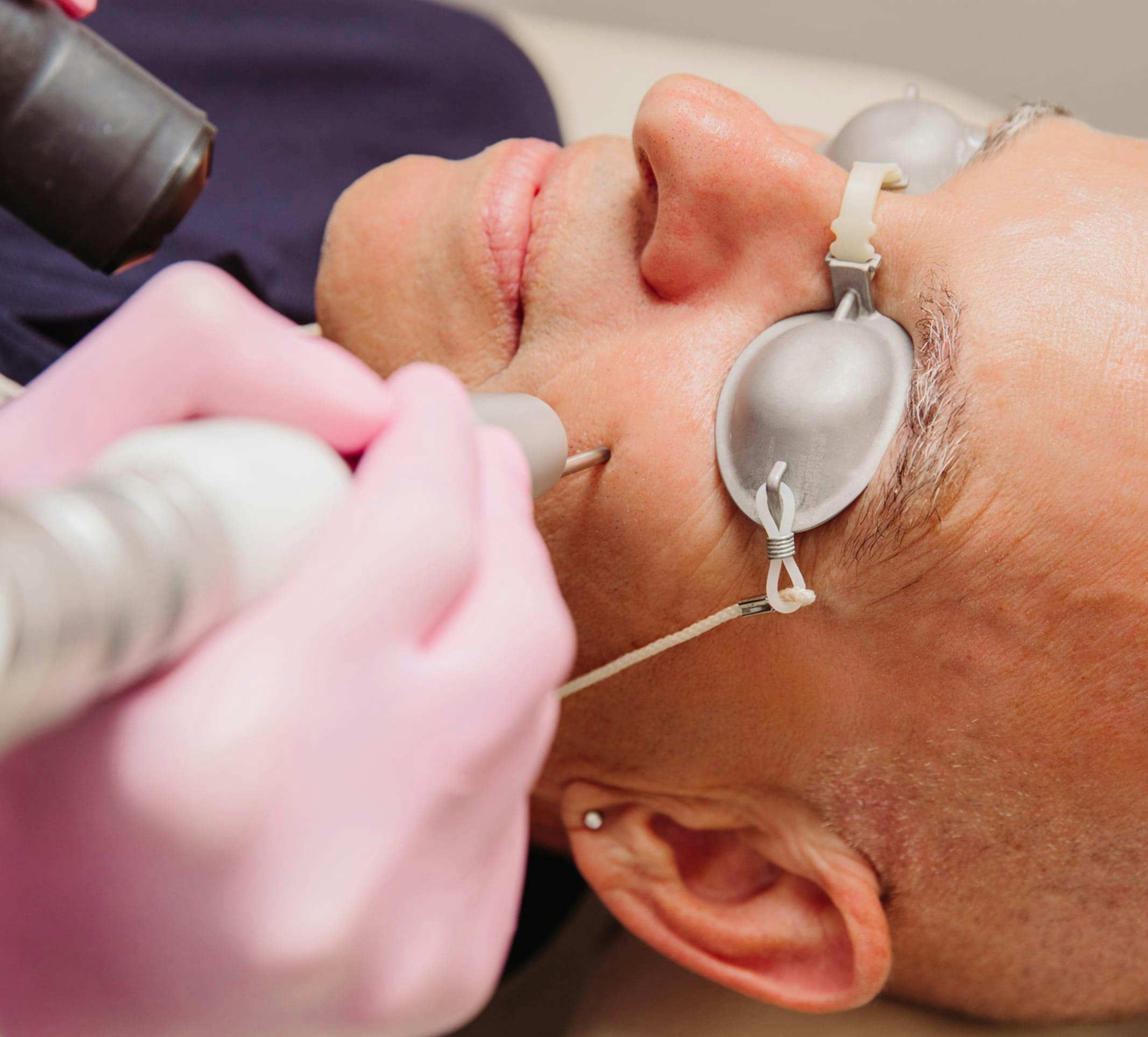 man getting skin rejuvenation treatment