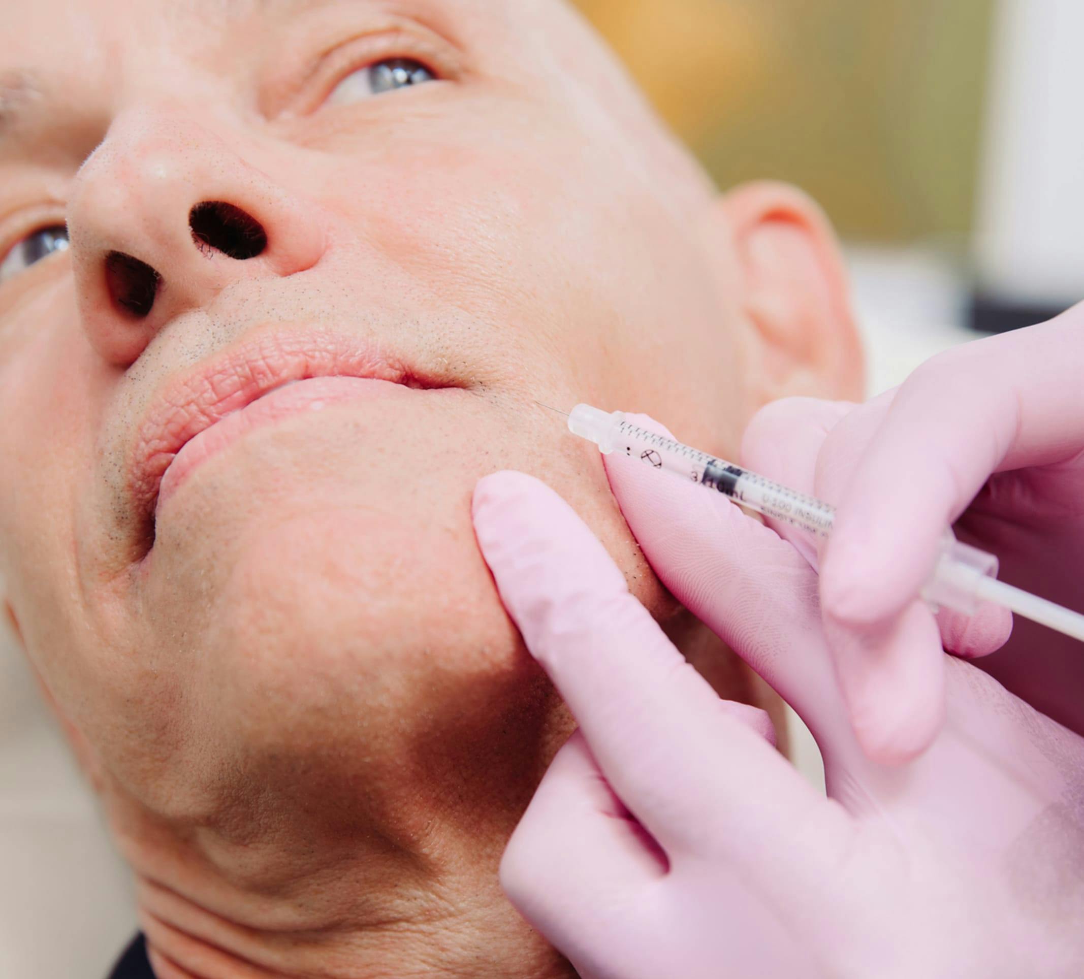 man getting facial fillers