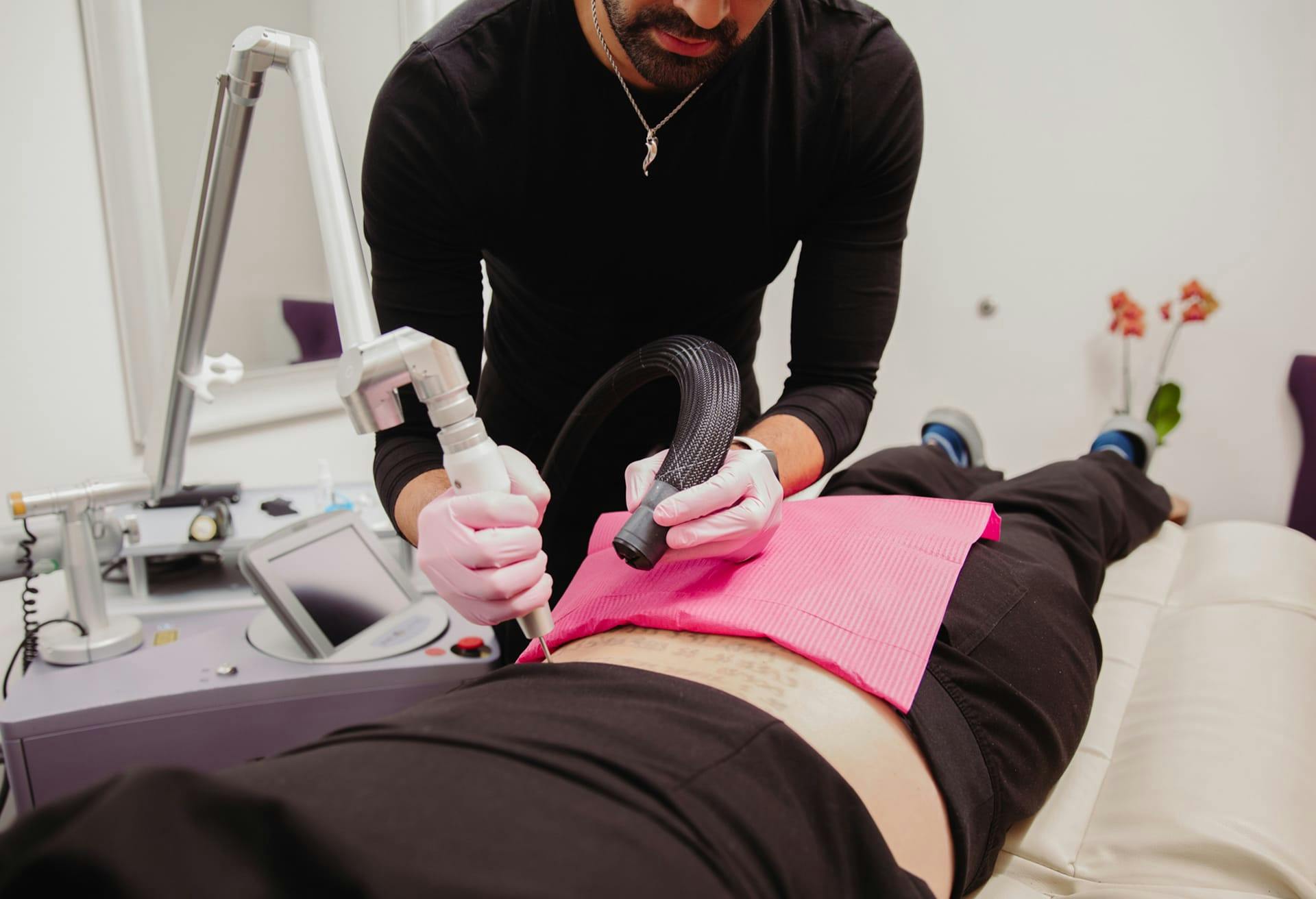 woman getting laser tattoo removal