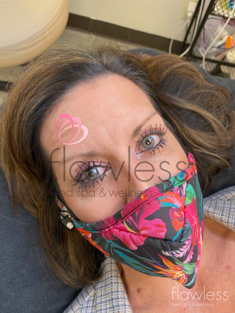 Permanent Make-up Before & After Gallery - Patient 58193386 - Image 1