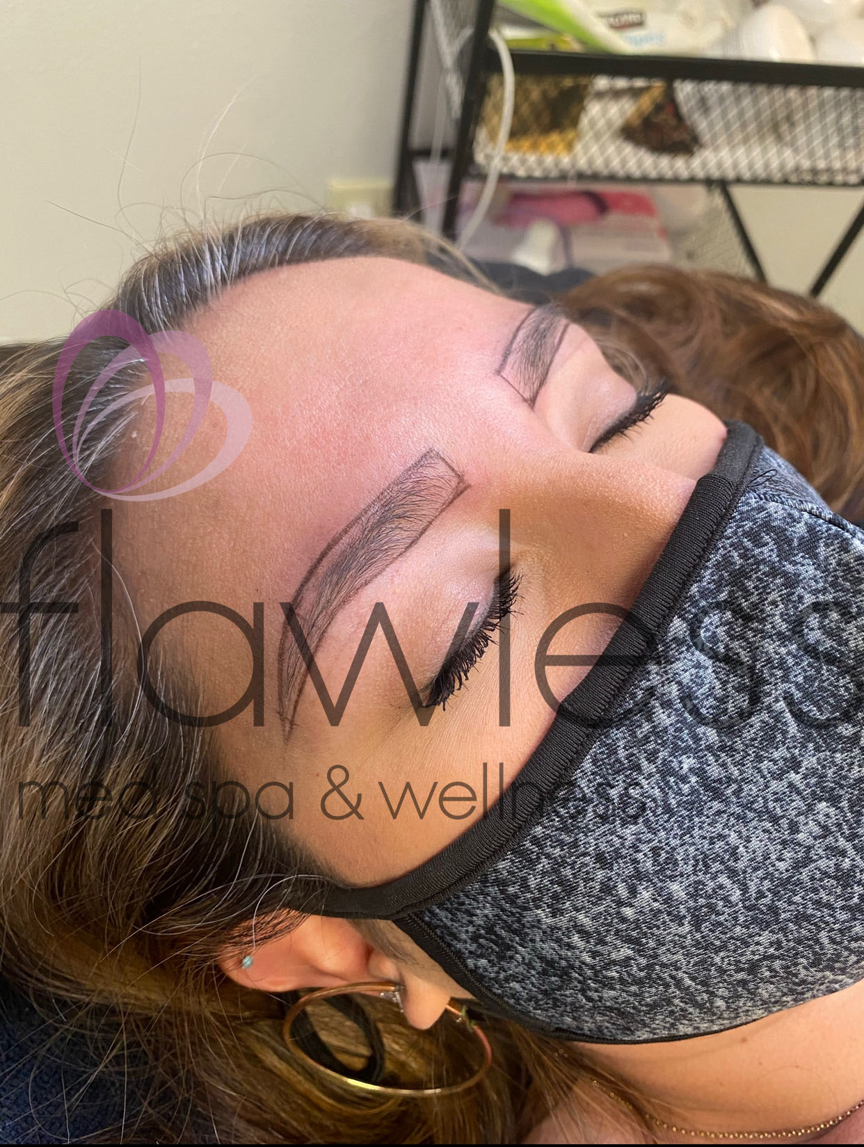 Permanent Make-up Before & After Gallery - Patient 58193389 - Image 1