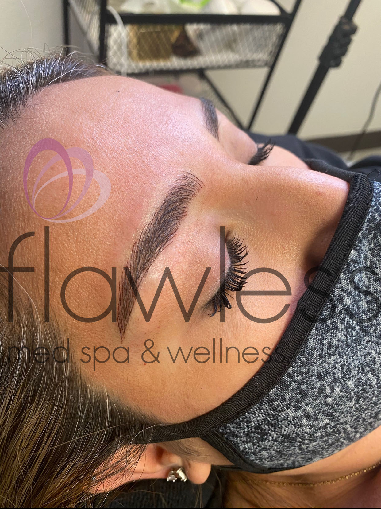 Permanent Make-up Before & After Gallery - Patient 58193389 - Image 2