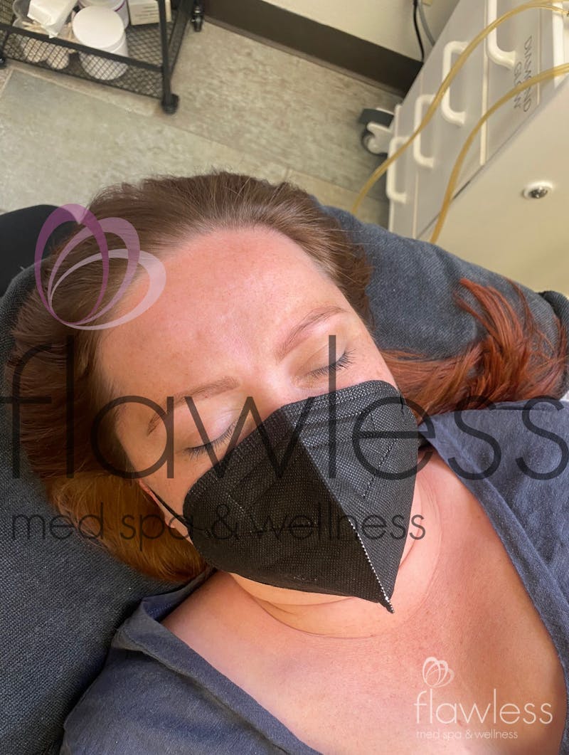 Permanent Make-up Before & After Gallery - Patient 58193392 - Image 1