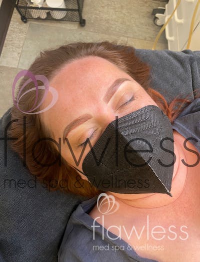 Permanent Make-up Before & After Gallery - Patient 58193392 - Image 2
