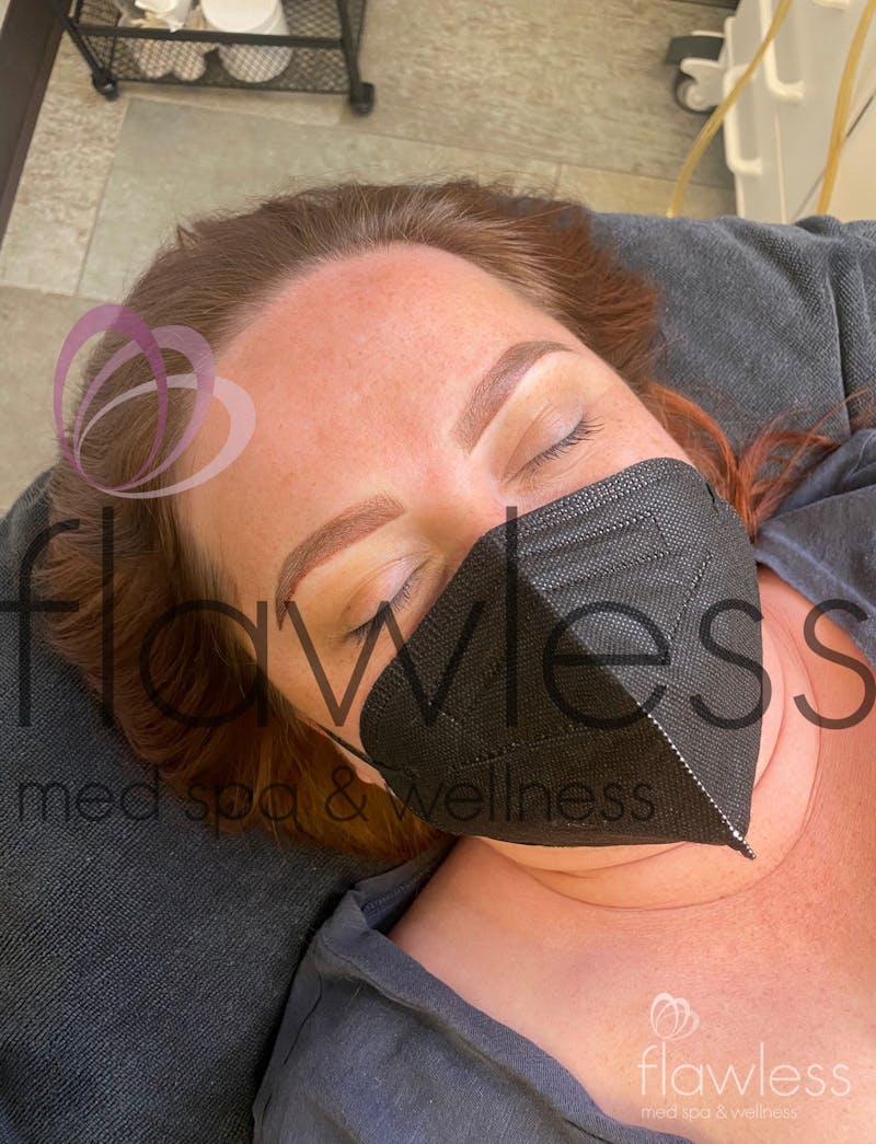 Permanent Make-up Before & After Gallery - Patient 58193392 - Image 2