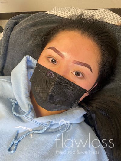 Permanent Make-up Before & After Gallery - Patient 58193395 - Image 2