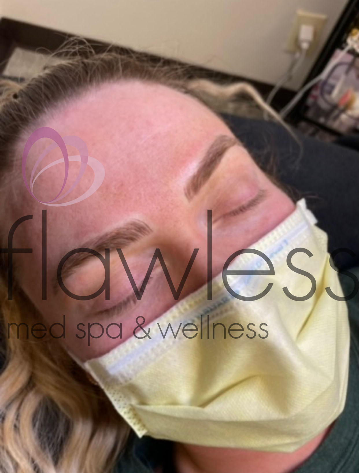 Permanent Make-up Before & After Gallery - Patient 58193398 - Image 2