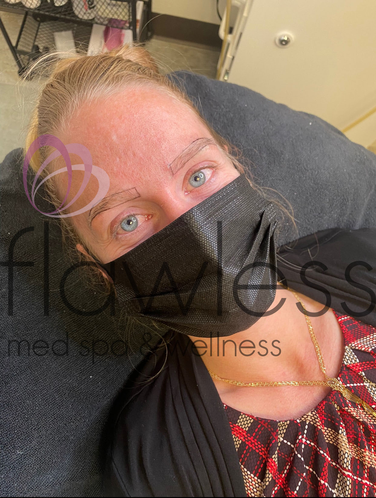 Permanent Make-up Before & After Gallery - Patient 58193408 - Image 1