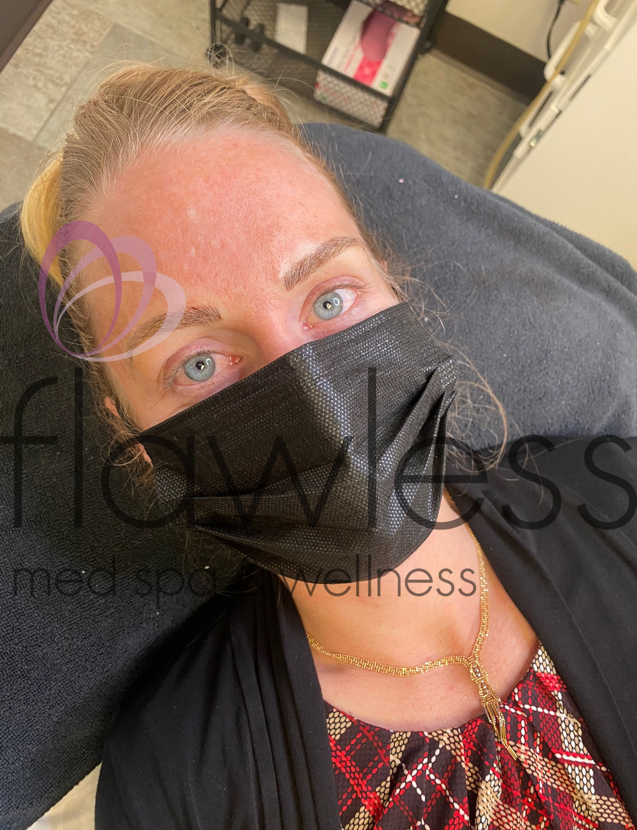 Permanent Make-up Before & After Gallery - Patient 58193408 - Image 2