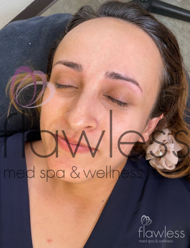 Permanent Make-up Before & After Gallery - Patient 58193411 - Image 1