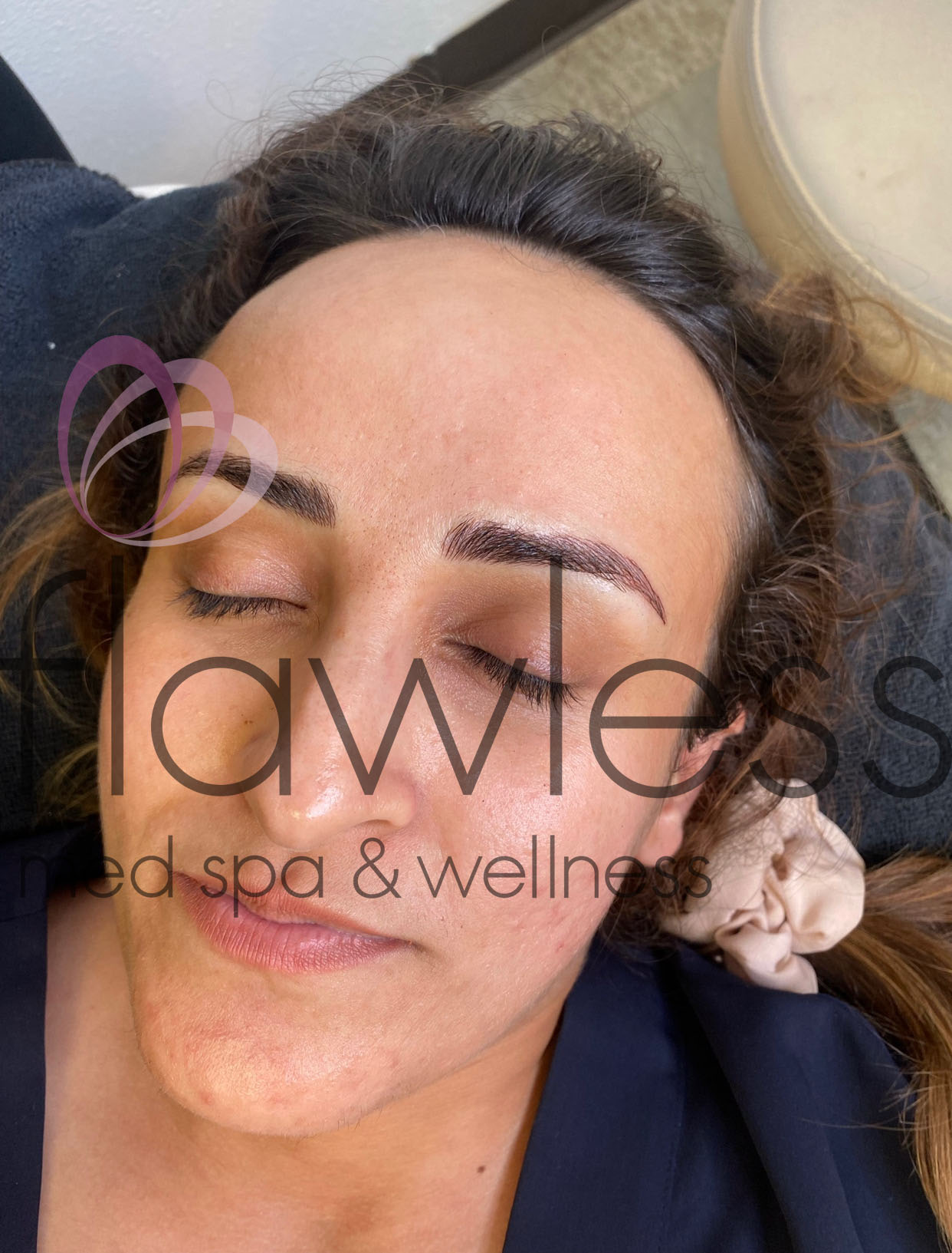 Permanent Make-up Before & After Gallery - Patient 58193411 - Image 2