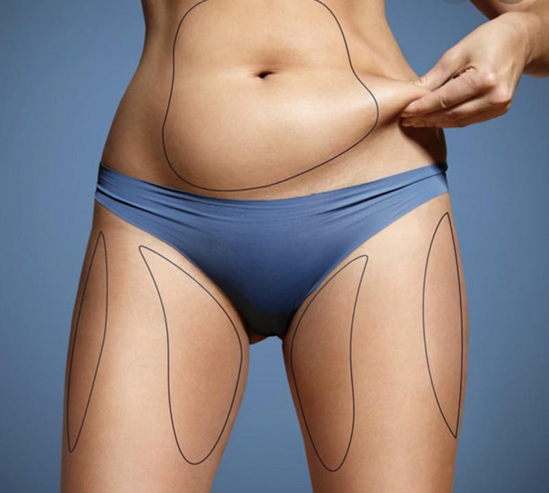 woman grabbing her loose skin