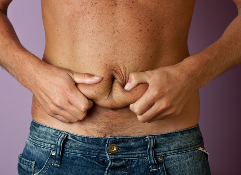 man squeezing extra skin on his stomach