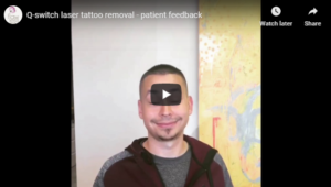 Flawless Medspa Blog | Q-switch laser tattoo removal – patient feedback
