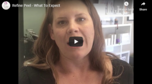 Flawless Medspa Podcast | Refine Peel – What To Expect