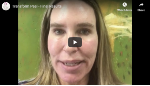Flawless Medspa Blog | Transform Peel – Final Results