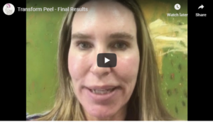 Flawless Medspa Podcast | Transform Peel – Final Results