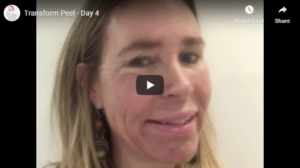 Flawless Medspa Podcast | Transform Peel – Day 4