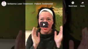 Flawless Medspa Blog | Melasma Laser Treatment – Patient Testimonial