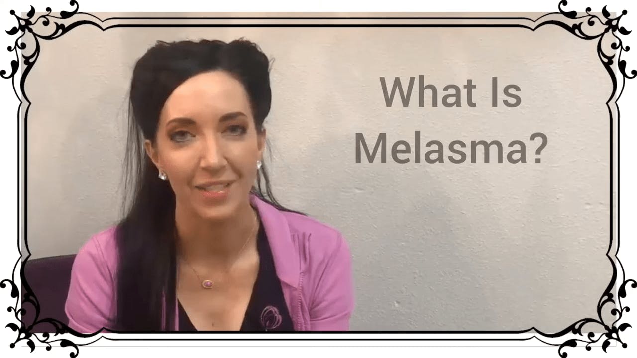 woman discussing melasma