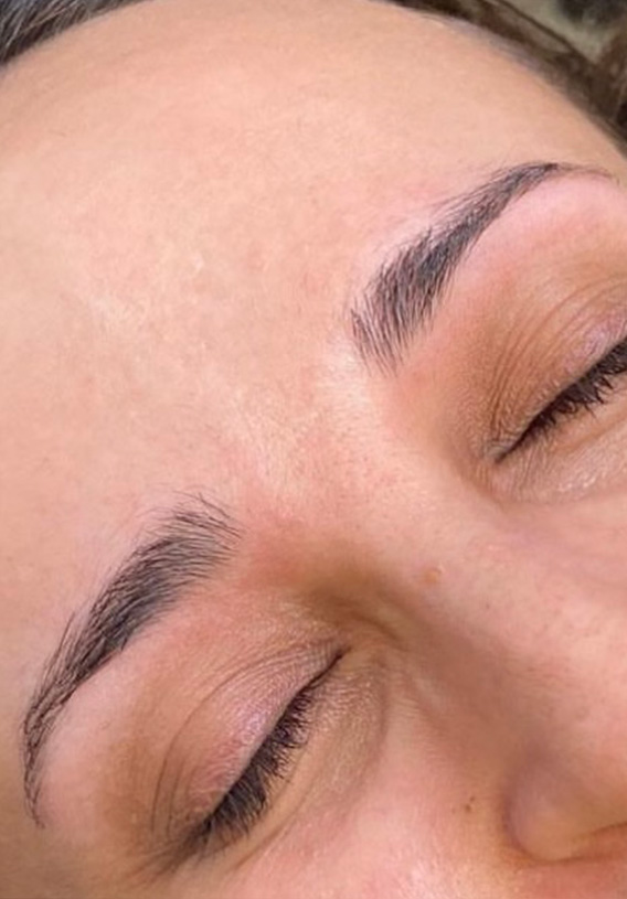 Permanent Make-up Before & After Gallery - Patient 176657381 - Image 1