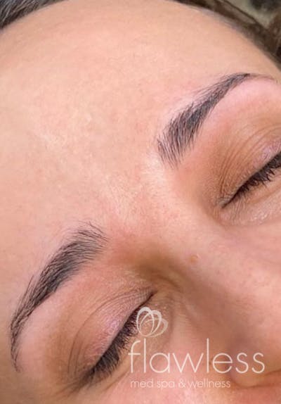 Permanent Make-up Before & After Gallery - Patient 176657381 - Image 1