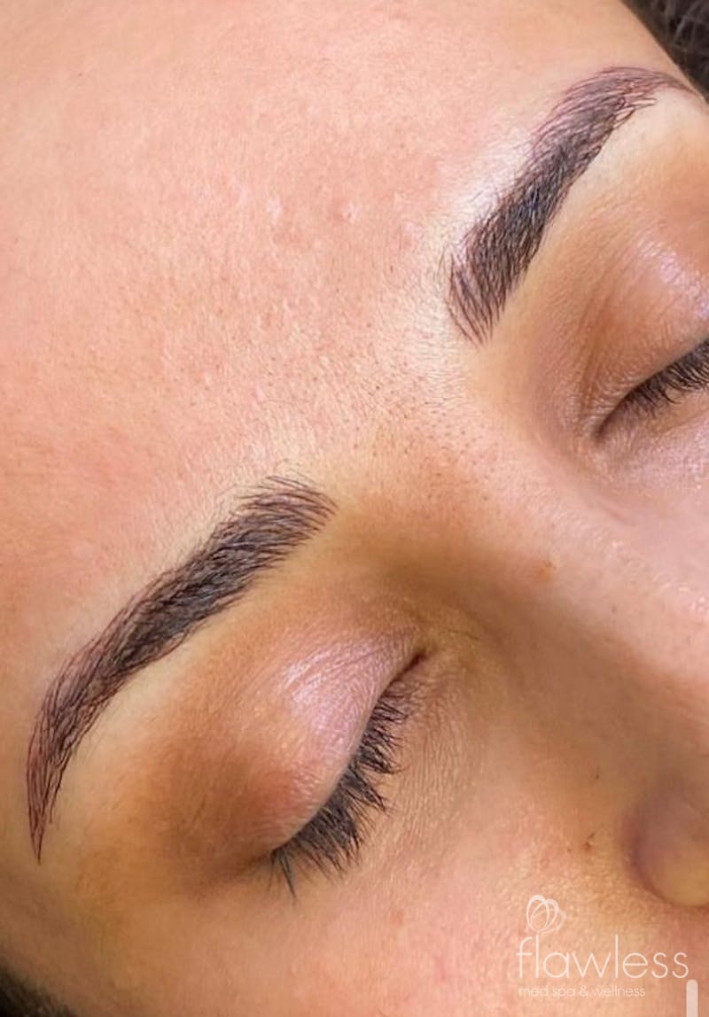 Permanent Make-up Before & After Gallery - Patient 176657381 - Image 2