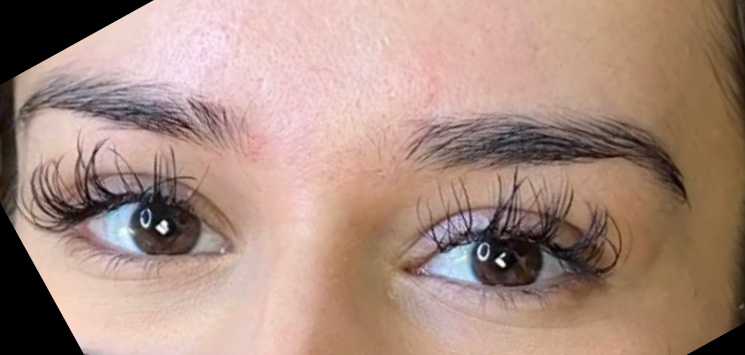 Permanent Make-up Before & After Gallery - Patient 176657380 - Image 1