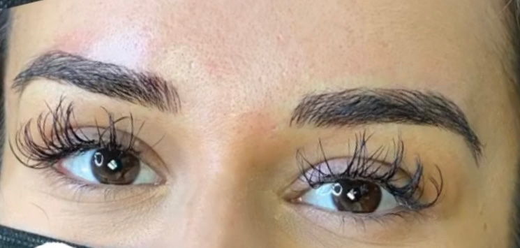 Permanent Make-up Before & After Gallery - Patient 176657380 - Image 2