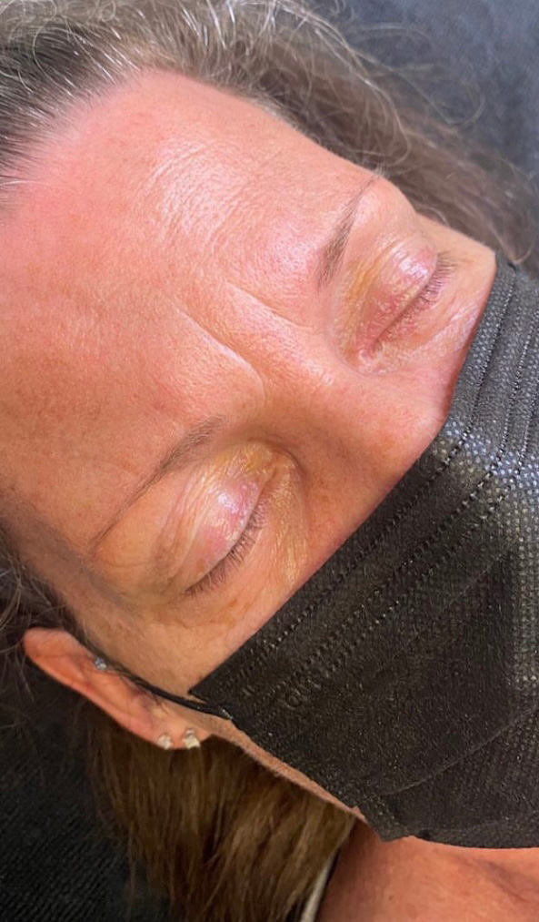 Permanent Make-up Before & After Gallery - Patient 176657378 - Image 1