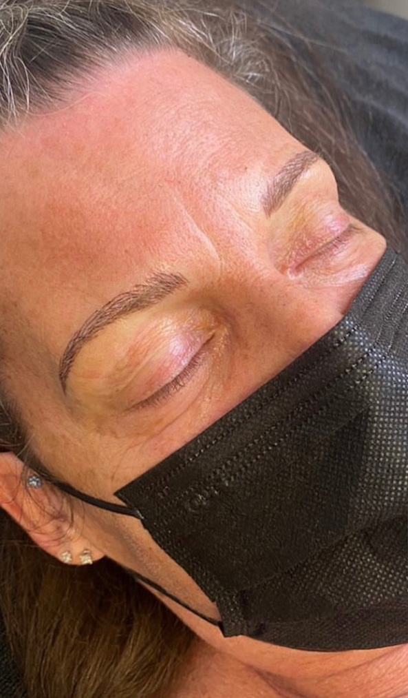 Permanent Make-up Before & After Gallery - Patient 176657378 - Image 2