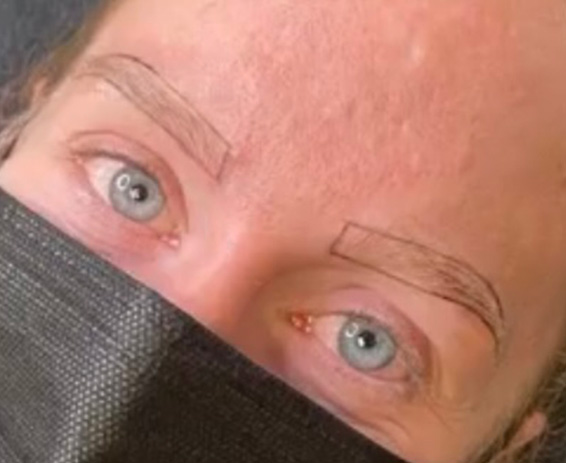 Permanent Make-up Before & After Gallery - Patient 176657366 - Image 1