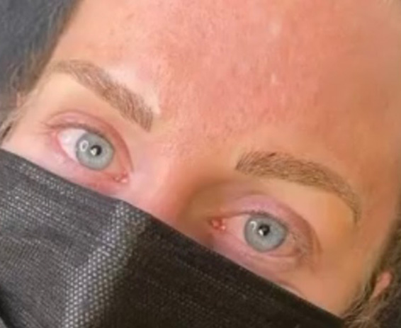 Permanent Make-up Before & After Gallery - Patient 176657366 - Image 2