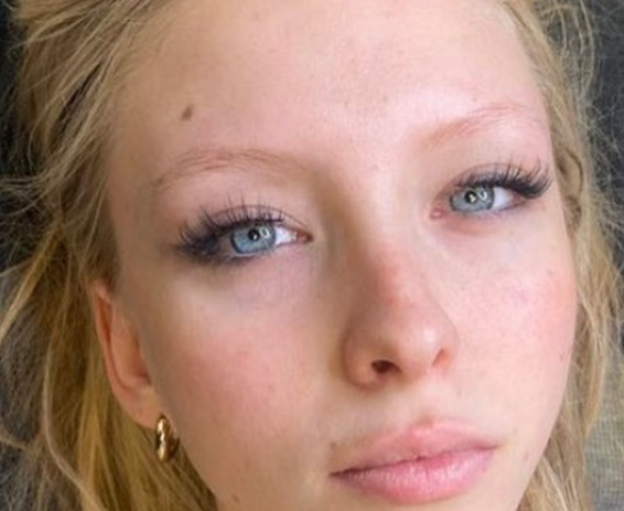 Permanent Make-up Before & After Gallery - Patient 176657374 - Image 1