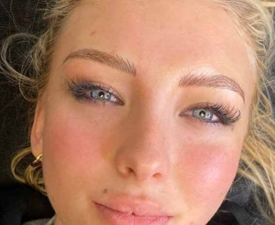 Permanent Make-up Before & After Gallery - Patient 176657374 - Image 2