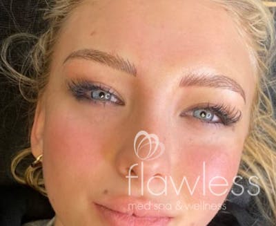 Permanent Make-up Before & After Gallery - Patient 176657374 - Image 2