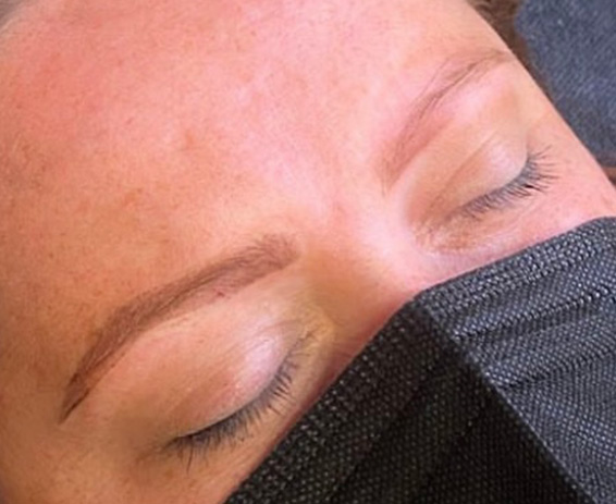 Permanent Make-up Before & After Gallery - Patient 176657370 - Image 1